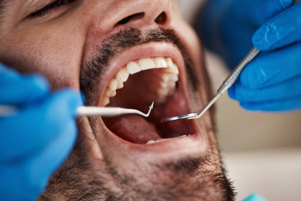 Best Emergency Denture Repair in Colonia, NJ
