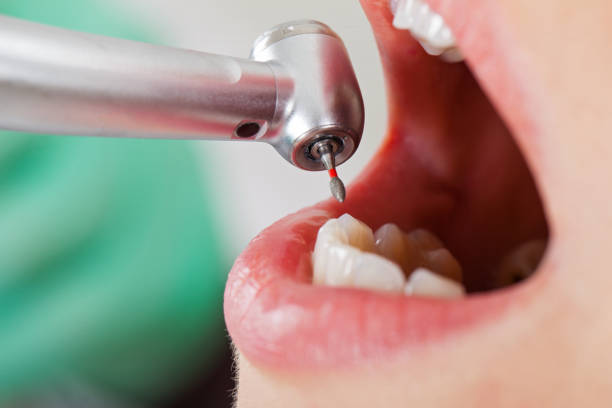 Best Emergency Treatment for Dental Infections or Abscesses in Colonia, NJ
